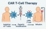 CAR T-Cell Therapy
